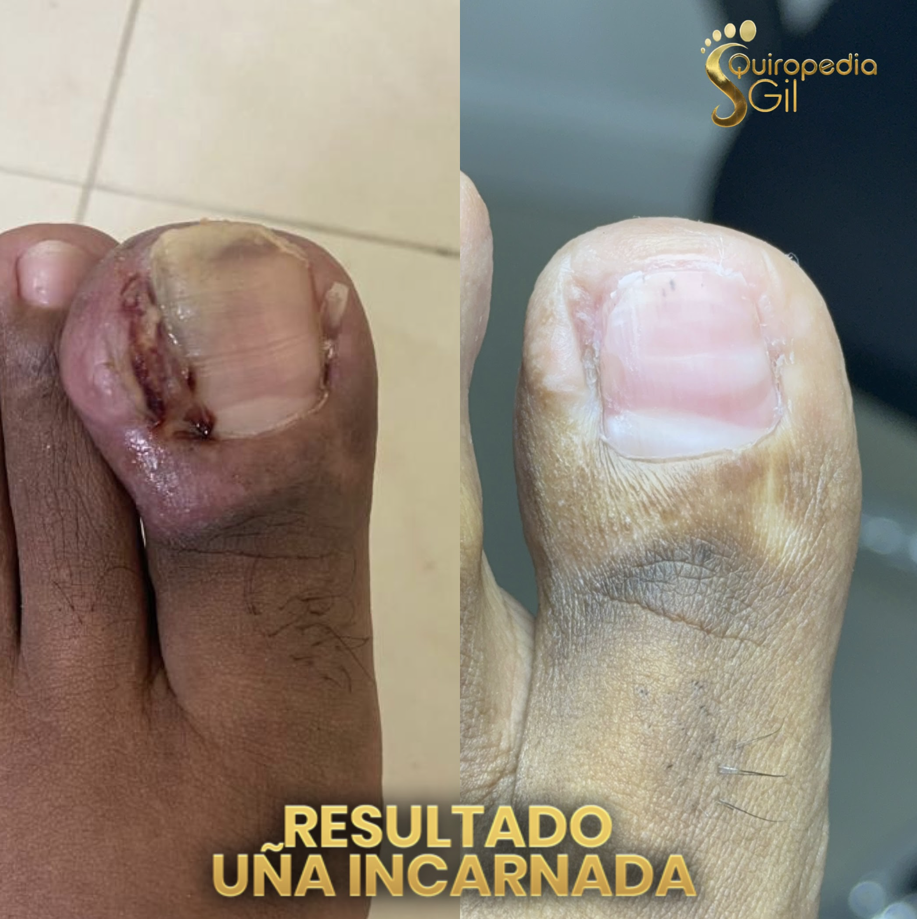 Evolución